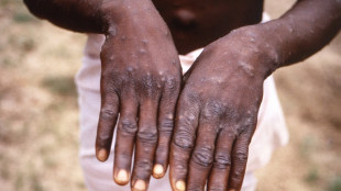 'Very ignorant rumour': Misinformation abounds about monkeypox