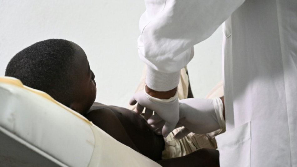 Côte d'Ivoire: 28 cas de mpox recensés dont un décès